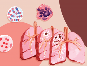 lung diseases